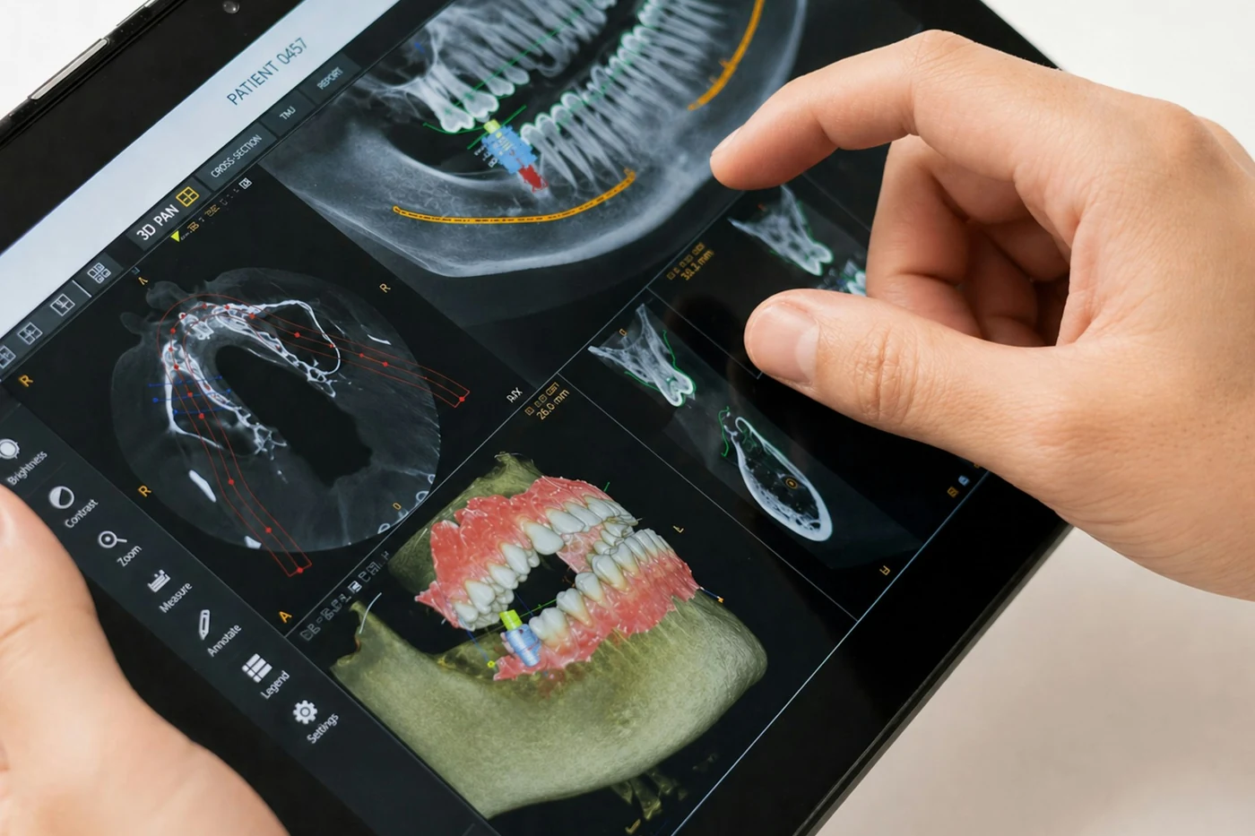Hand tippt auf ein Tablet mit dem 3D-Röntgenbild eines Kiefers